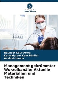 bokomslag Management gekrümmter Wurzelkanäle: Aktuelle Materialien und Techniken