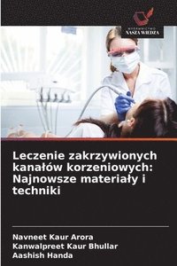 bokomslag Leczenie zakrzywionych kanalów korzeniowych: Najnowsze materialy i techniki