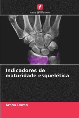 Indicadores de maturidade esquelética