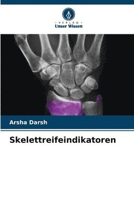 bokomslag Skelettreifeindikatoren
