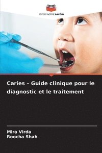 bokomslag Caries - Guide clinique pour le diagnostic et le traitement