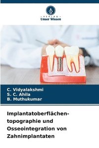 bokomslag Implantatoberflächen- topographie und Osseointegration von Zahnimplantaten
