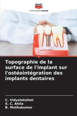 Topographie de la surface de l'implant sur l'ostéointégration des implants dentaires