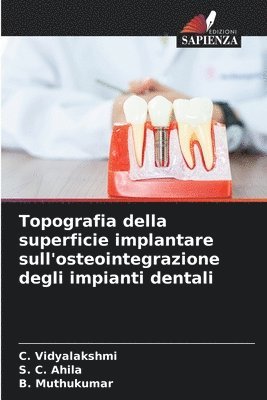 bokomslag Topografia della superficie implantare sull'osteointegrazione degli impianti dentali
