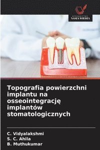 bokomslag Topografia powierzchni implantu na osseointegracj? implantów stomatologicznych