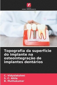 bokomslag Topografia da superfície do implante na osteointegração de implantes dentários