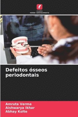 Amruta Verma, Aishwarya Ikhar, Abhay Kolte - Defeitos ósseos periodontais, Häftad