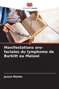 bokomslag Manifestations oro-faciales du lymphome de Burkitt au Malawi