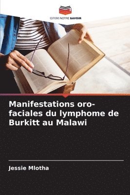bokomslag Manifestations oro-faciales du lymphome de Burkitt au Malawi