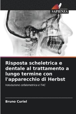 bokomslag Risposta scheletrica e dentale al trattamento a lungo termine con l'apparecchio di Herbst