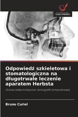 bokomslag Odpowied? szkieletowa i stomatologiczna na dlugotrwale leczenie aparatem Herbsta