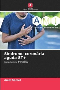 bokomslag Síndrome coronária aguda ST+