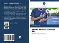 bokomslag Akutes Koronarsyndrom ST+