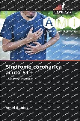 Sindrome coronarica acuta ST+