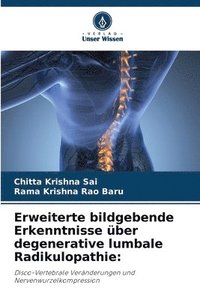 bokomslag Erweiterte bildgebende Erkenntnisse über degenerative lumbale Radikulopathie