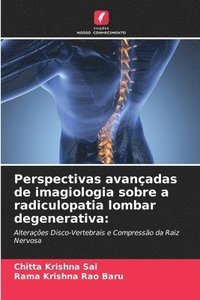 bokomslag Perspectivas avançadas de imagiologia sobre a radiculopatia lombar degenerativa