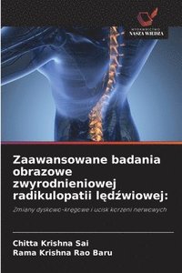 bokomslag Zaawansowane badania obrazowe zwyrodnieniowej radikulopatii l?d?wiowej