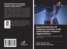 Chitta Krishna Sai, Rama Krishna Rao Baru - Approfondimenti di imaging avanzato sulla radicolopatia lombare degenerativa, Häftad