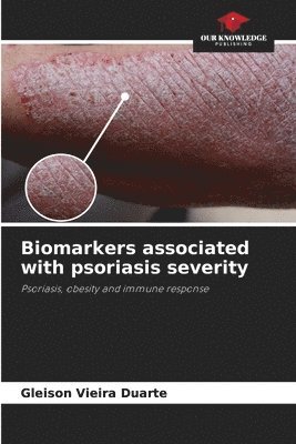 bokomslag Biomarkers associated with psoriasis severity