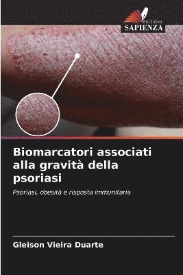 bokomslag Biomarcatori associati alla gravità della psoriasi