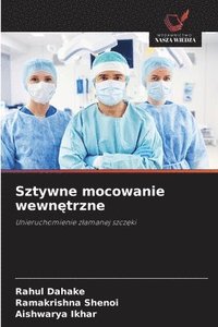 bokomslag Sztywne mocowanie wewn?trzne