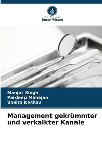bokomslag Management gekrümmter und verkalkter Kanäle