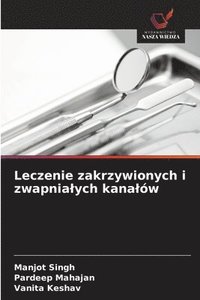 bokomslag Leczenie zakrzywionych i zwapnialych kanalów