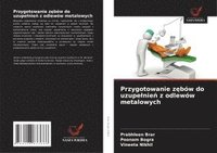 bokomslag Przygotowanie z¿bów do uzupe¿nie¿ z odlewów metalowych