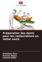 bokomslag Préparation des dents pour les restaurations en métal coulé