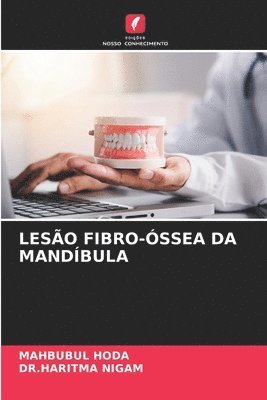 bokomslag Lesão Fibro-Óssea Da Mandíbula