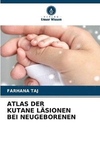 bokomslag Atlas Der Kutane Läsionen Bei Neugeborenen