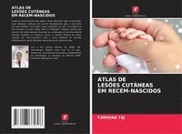 bokomslag Atlas de Lesões Cutâneas Em Recém-Nascidos