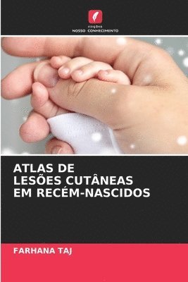 bokomslag Atlas de Lesões Cutâneas Em Recém-Nascidos