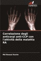 bokomslag Correlazione degli anticorpi anti-CCP con l'attività della malattia RA