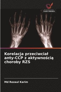 bokomslag Korelacja przeciwcial anty-CCP z aktywno?ci? choroby RZS