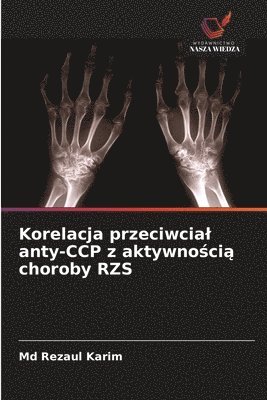 bokomslag Korelacja przeciwcial anty-CCP z aktywno?ci? choroby RZS