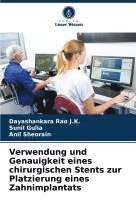 bokomslag Verwendung und Genauigkeit eines chirurgischen Stents zur Platzierung eines Zahnimplantats
