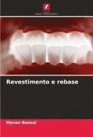 bokomslag Revestimento e rebase