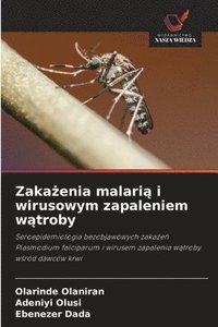 bokomslag Zaka?enia malari? i wirusowym zapaleniem w?troby