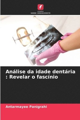 bokomslag Análise da idade dentária: Revelar o fascínio