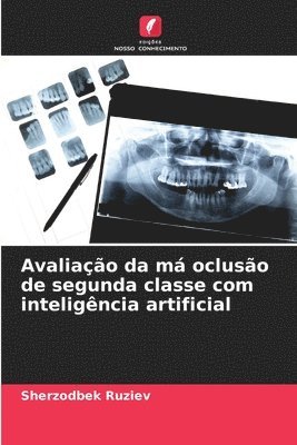 bokomslag Avaliação da má oclusão de segunda classe com inteligência artificial