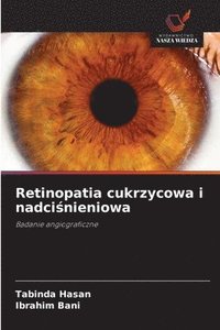 bokomslag Retinopatia cukrzycowa i nadci?nieniowa