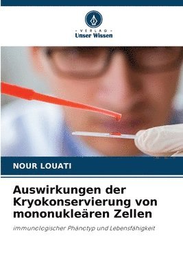 bokomslag Auswirkungen der Kryokonservierung von mononukleären Zellen