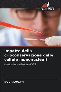 bokomslag Impatto della crioconservazione delle cellule mononucleari