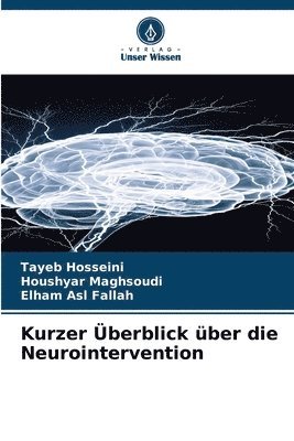 bokomslag Kurzer Überblick über die Neurointervention