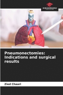 bokomslag Pneumonectomies: Indications and surgical results