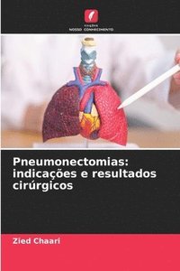 bokomslag Pneumonectomias: indicações e resultados cirúrgicos