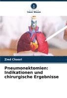 bokomslag Pneumonektomien: Indikationen und chirurgische Ergebnisse
