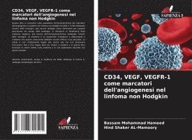 Bassam Mohammad Hameed, Hind Shaker Al-Mamoory, Hind Shaker AL-Mamoory - CD34, VEGF, VEGFR-1 come marcatori dell'angiogenesi nel linfoma non Hodgkin, Häftad