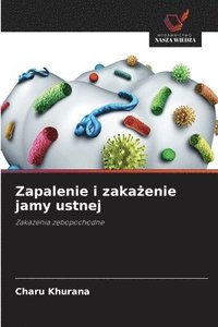 bokomslag Zapalenie i zaka?enie jamy ustnej